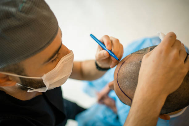 Hair Transplant in Abu Dhabi: Restoring Your Natural Look