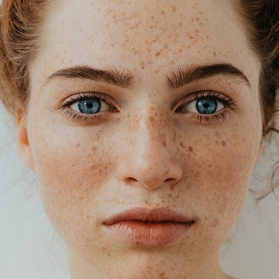 The Best Pigmentation Treatments for Different Skin Types?