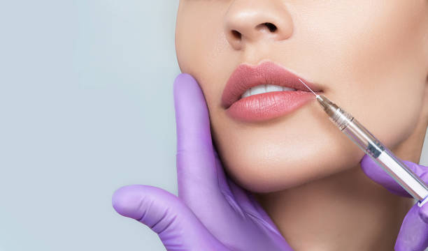 Pucker Up Perfectly: Russian Lip Fillers in Abu Dhabi