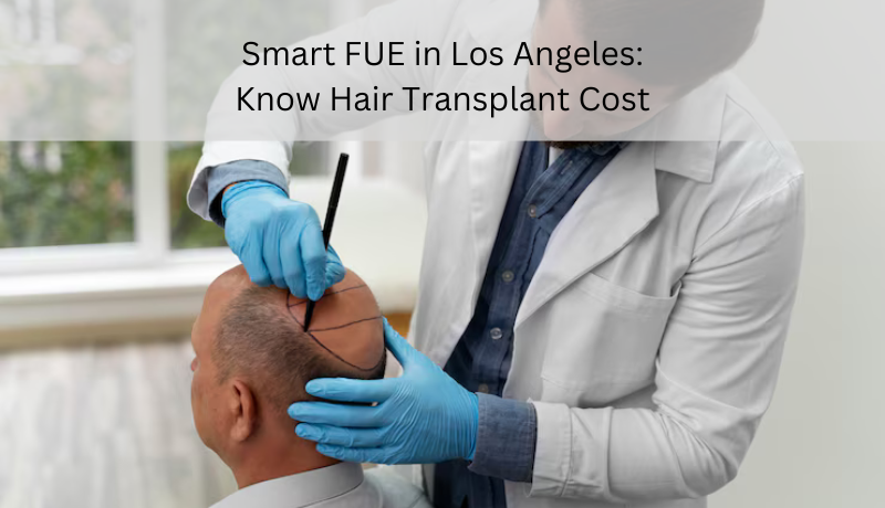 smart FUE hair transplant cost Los Angeles