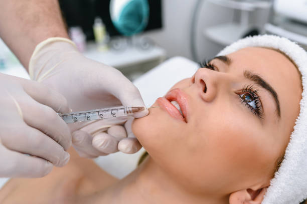 Russian Lip Fillers in Abu Dhabi: Say Hello to Perfect Lips